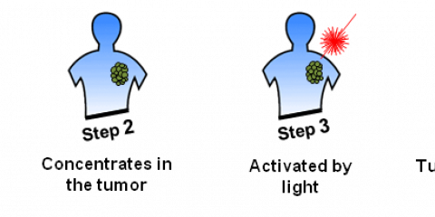 光動力療法(PDT)